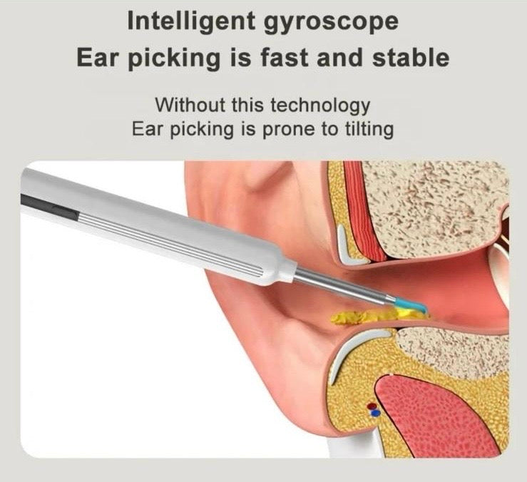 High-Precision Ear Cleaner with Camera - Wireless Otoscope for Safe and Smart Ear Cleaning