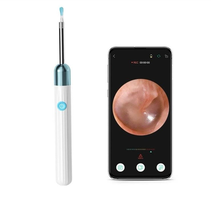 High-Precision Ear Cleaner with Camera - Wireless Otoscope for Safe and Smart Ear Cleaning