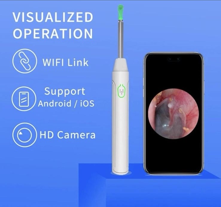 High-Precision Ear Cleaner with Camera - Wireless Otoscope for Safe and Smart Ear Cleaning